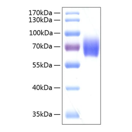 SDS-PAGE - Recombinant Human alpha 2 Antiplasmin Protein (C-terminal His Tag) (A330089) - Antibodies.com