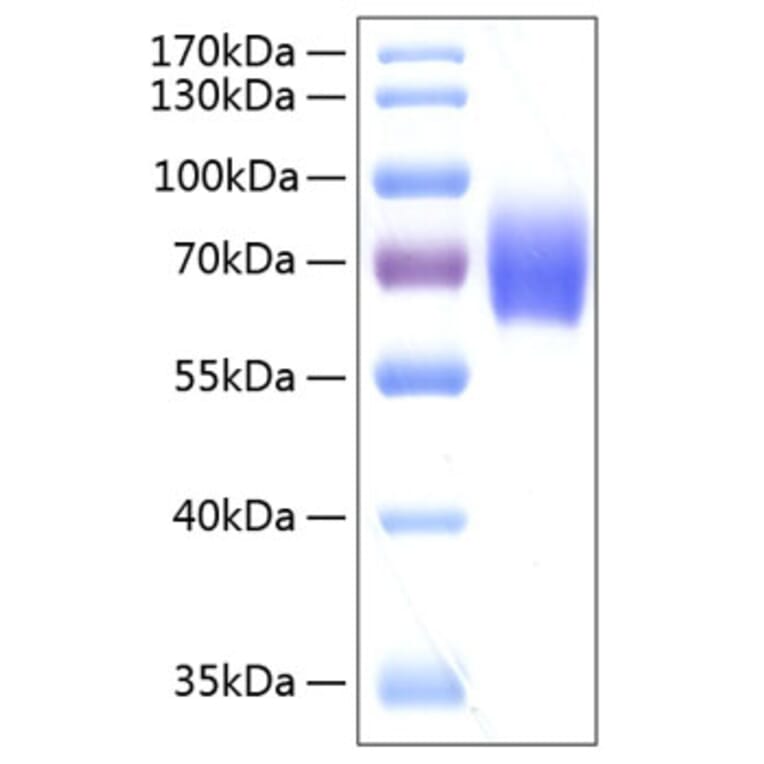 SDS-PAGE - Recombinant Human alpha 2 Antiplasmin Protein (C-terminal His Tag) (A330089) - Antibodies.com