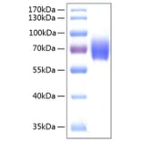 SDS-PAGE - Recombinant Human alpha 2 Antiplasmin Protein (C-terminal His Tag) (A330089) - Antibodies.com