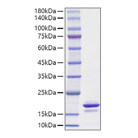 SDS-PAGE - Recombinant Human alpha Synuclein Protein (A330090) - Antibodies.com