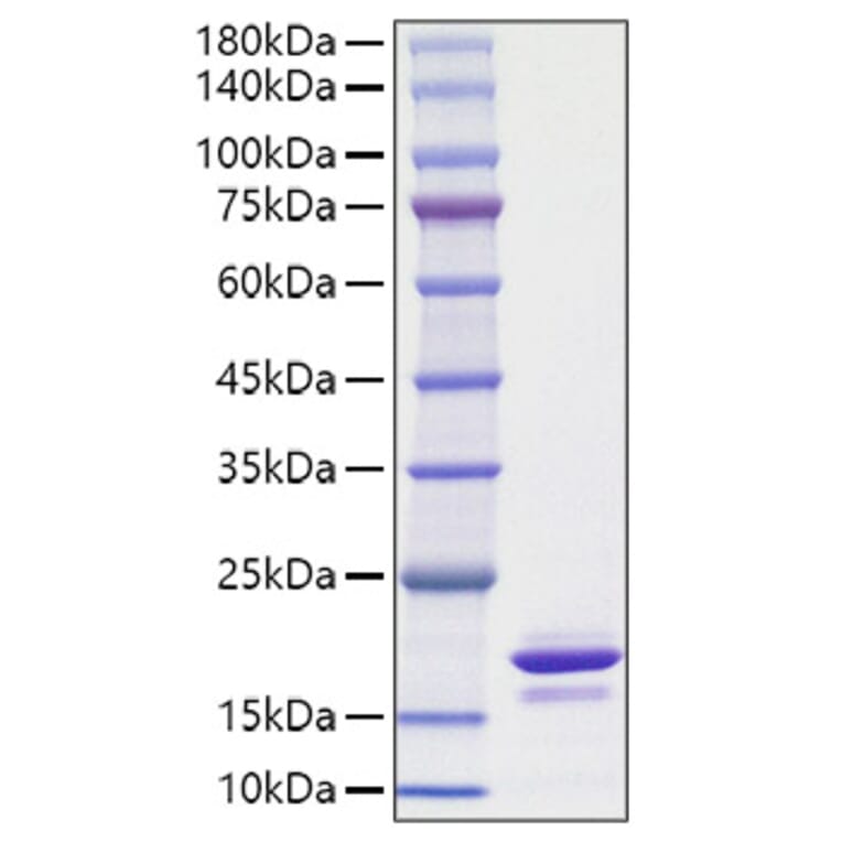 SDS-PAGE - Recombinant Human alpha Synuclein Protein (A330090) - Antibodies.com