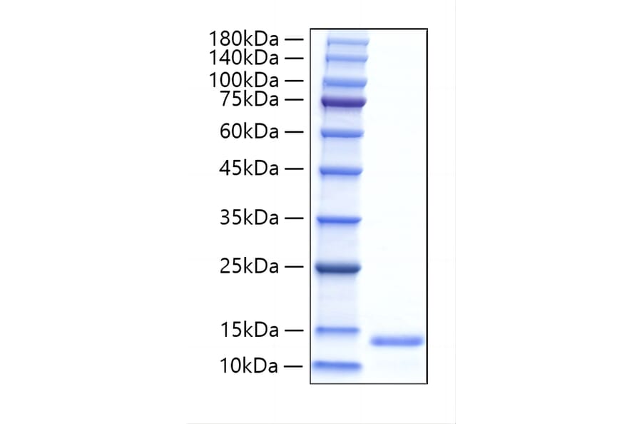 SDS-PAGE - Recombinant Human ALR Protein (N-terminal His Tag) (A330091) - Antibodies.com