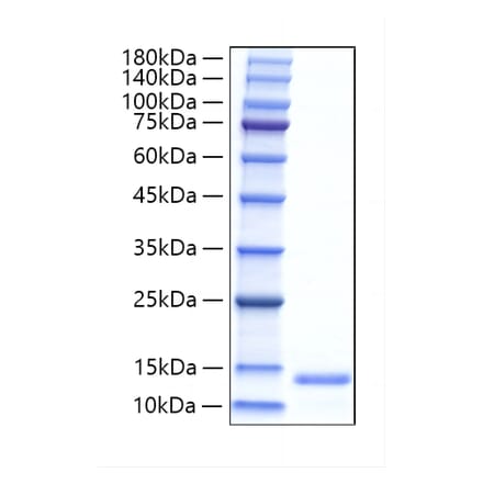 SDS-PAGE - Recombinant Human ALR Protein (N-terminal His Tag) (A330091) - Antibodies.com