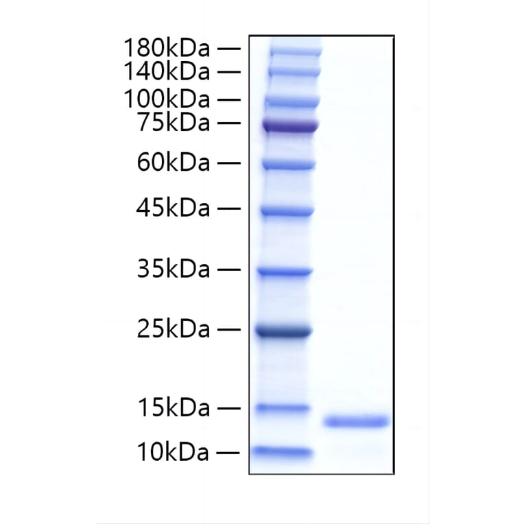 SDS-PAGE - Recombinant Human ALR Protein (N-terminal His Tag) (A330091) - Antibodies.com