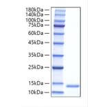 SDS-PAGE - Recombinant Human ALR Protein (N-terminal His Tag) (A330091) - Antibodies.com