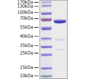 SDS-PAGE - Recombinant Human AMH Protein (N-terminal His Tag) (A330093) - Antibodies.com