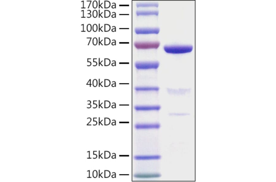 SDS-PAGE - Recombinant Human AMH Protein (N-terminal His Tag) (A330093) - Antibodies.com