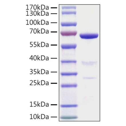 SDS-PAGE - Recombinant Human AMH Protein (N-terminal His Tag) (A330093) - Antibodies.com