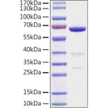 SDS-PAGE - Recombinant Human AMH Protein (N-terminal His Tag) (A330093) - Antibodies.com