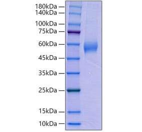 SDS-PAGE - Recombinant Human AMHR2 Protein (C-terminal Human Fc Tag) (A330094) - Antibodies.com