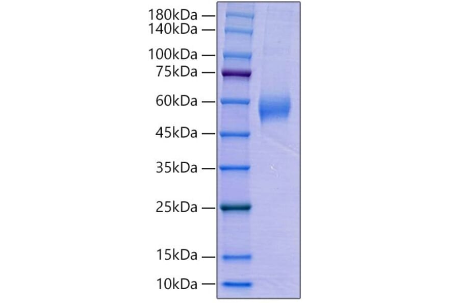 SDS-PAGE - Recombinant Human AMHR2 Protein (C-terminal Human Fc Tag) (A330094) - Antibodies.com