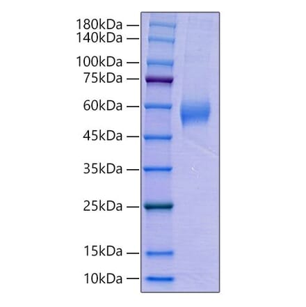 SDS-PAGE - Recombinant Human AMHR2 Protein (C-terminal Human Fc Tag) (A330094) - Antibodies.com