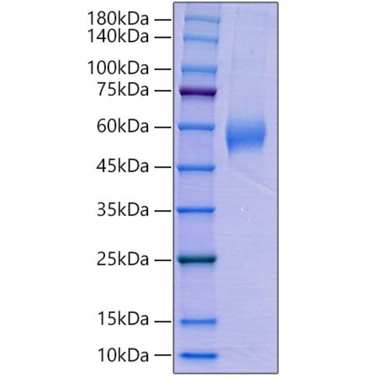 SDS-PAGE - Recombinant Human AMHR2 Protein (C-terminal Human Fc Tag) (A330094) - Antibodies.com