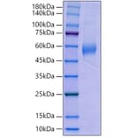 SDS-PAGE - Recombinant Human AMHR2 Protein (C-terminal Human Fc Tag) (A330094) - Antibodies.com