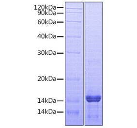 SDS-PAGE - Recombinant Human Amphiregulin Protein (A330095) - Antibodies.com