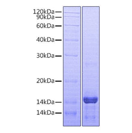SDS-PAGE - Recombinant Human Amphiregulin Protein (A330095) - Antibodies.com