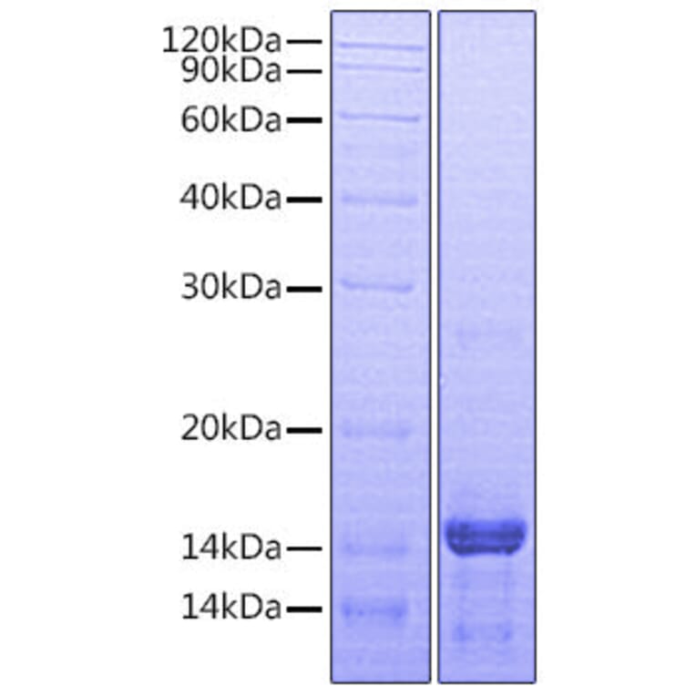 SDS-PAGE - Recombinant Human Amphiregulin Protein (A330095) - Antibodies.com