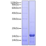SDS-PAGE - Recombinant Human Amphiregulin Protein (A330095) - Antibodies.com