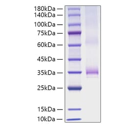 SDS-PAGE - Recombinant Human Angiopoietin 1 Protein (C-terminal His Tag) (A330096) - Antibodies.com