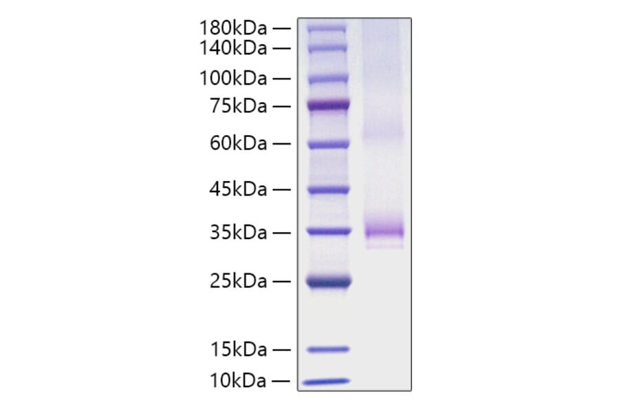 SDS-PAGE - Recombinant Human Angiopoietin 1 Protein (C-terminal His Tag) (A330096) - Antibodies.com