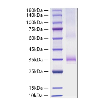 SDS-PAGE - Recombinant Human Angiopoietin 1 Protein (C-terminal His Tag) (A330096) - Antibodies.com