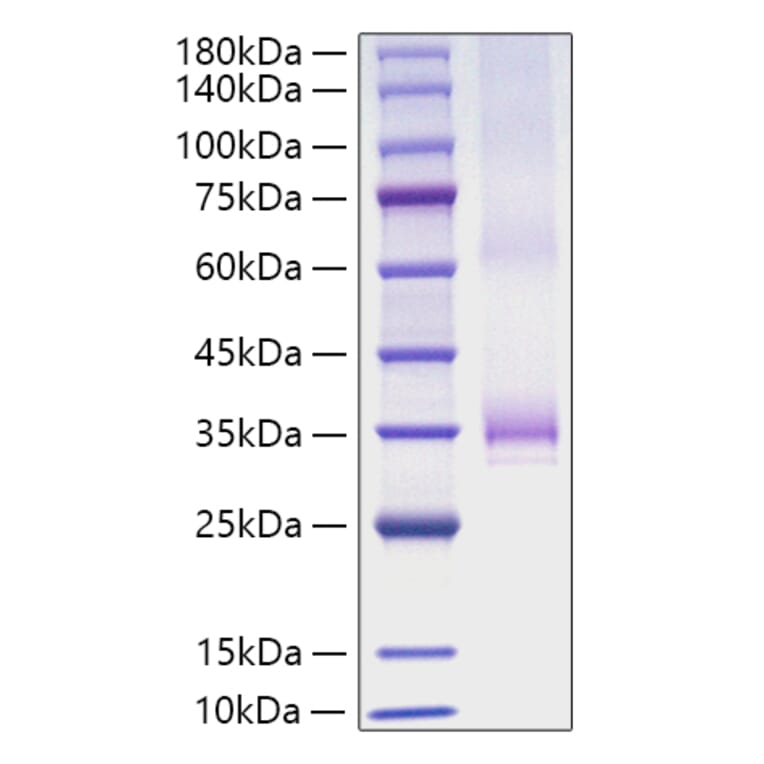SDS-PAGE - Recombinant Human Angiopoietin 1 Protein (C-terminal His Tag) (A330096) - Antibodies.com