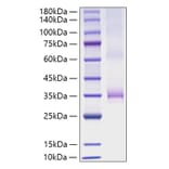 SDS-PAGE - Recombinant Human Angiopoietin 1 Protein (C-terminal His Tag) (A330096) - Antibodies.com
