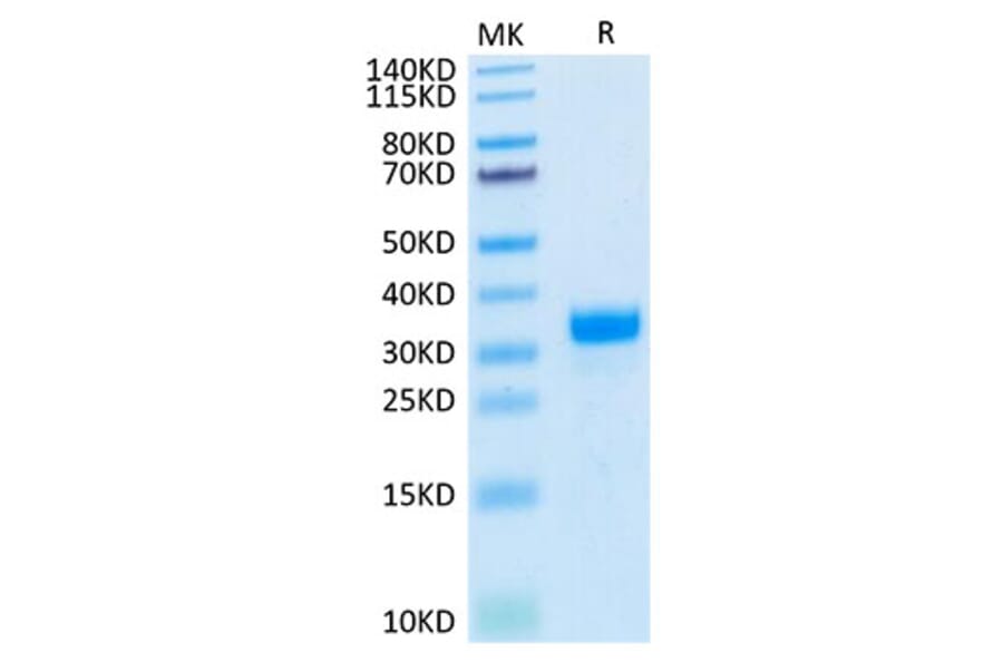 Tris-Bis PAGE - Recombinant Human Angiopoietin 2 Protein (Biotin) (N-terminal His and Avi Tag) (A330097) - Antibodies.com