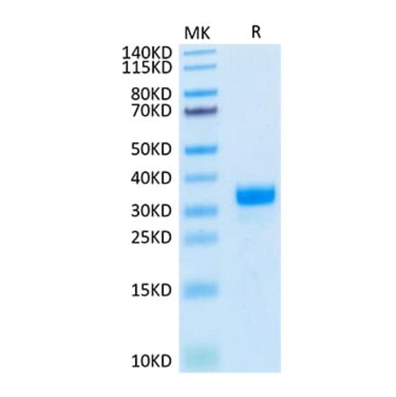 Tris-Bis PAGE - Recombinant Human Angiopoietin 2 Protein (Biotin) (N-terminal His and Avi Tag) (A330097) - Antibodies.com