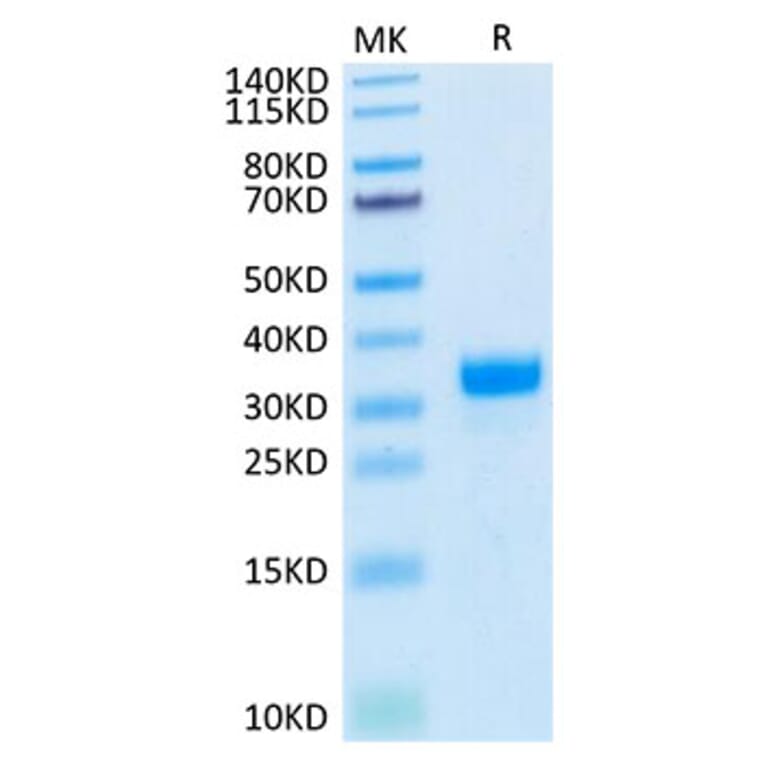 Tris-Bis PAGE - Recombinant Human Angiopoietin 2 Protein (Biotin) (N-terminal His and Avi Tag) (A330097) - Antibodies.com