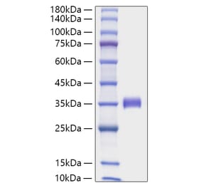SDS-PAGE - Recombinant Human Angiopoietin 2 Protein (C-terminal His Tag) (A330098) - Antibodies.com