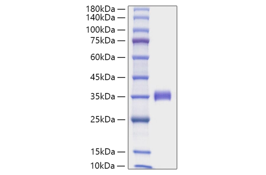 SDS-PAGE - Recombinant Human Angiopoietin 2 Protein (C-terminal His Tag) (A330098) - Antibodies.com