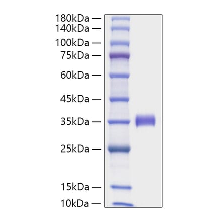 SDS-PAGE - Recombinant Human Angiopoietin 2 Protein (C-terminal His Tag) (A330098) - Antibodies.com