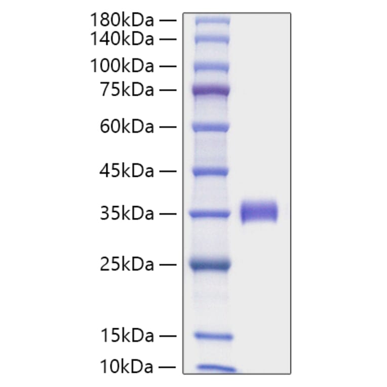SDS-PAGE - Recombinant Human Angiopoietin 2 Protein (C-terminal His Tag) (A330098) - Antibodies.com