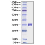 SDS-PAGE - Recombinant Human Angiopoietin 2 Protein (C-terminal His Tag) (A330098) - Antibodies.com