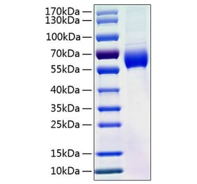 SDS-PAGE - Recombinant Human Angiotensinogen Protein (C-terminal His Tag) (A330099) - Antibodies.com