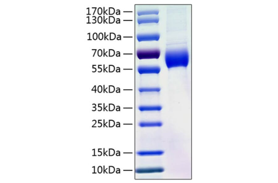 SDS-PAGE - Recombinant Human Angiotensinogen Protein (C-terminal His Tag) (A330099) - Antibodies.com