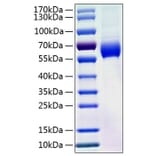SDS-PAGE - Recombinant Human Angiotensinogen Protein (C-terminal His Tag) (A330099) - Antibodies.com