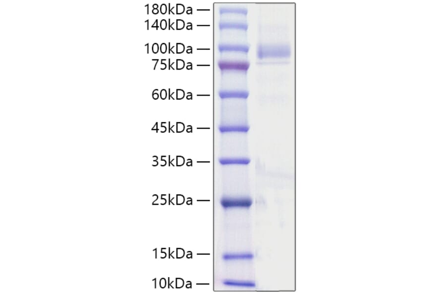 SDS-PAGE - Recombinant Human ANGPT4 Protein (C-terminal His Tag) (A330100) - Antibodies.com