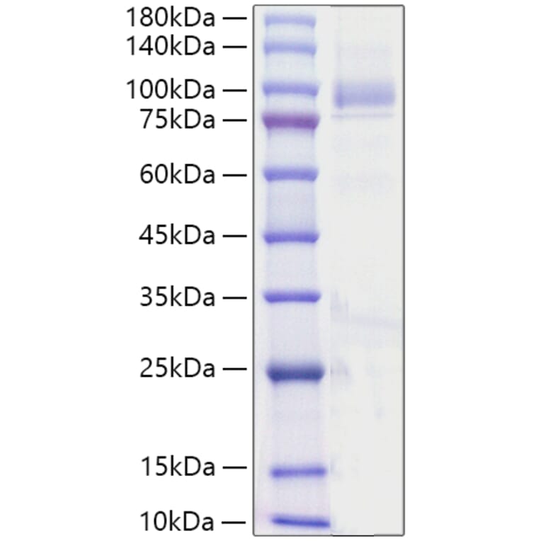 SDS-PAGE - Recombinant Human ANGPT4 Protein (C-terminal His Tag) (A330100) - Antibodies.com