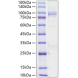 SDS-PAGE - Recombinant Human ANGPT4 Protein (C-terminal His Tag) (A330100) - Antibodies.com