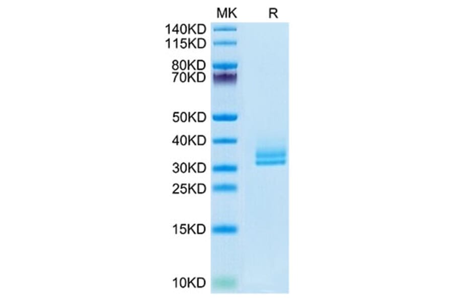 Tris-Bis PAGE - Recombinant Human ANGPTL2 Protein (Biotin) (C-terminal His and Avi Tag) (A330101) - Antibodies.com