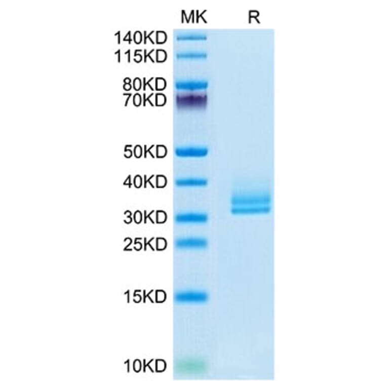 Tris-Bis PAGE - Recombinant Human ANGPTL2 Protein (Biotin) (C-terminal His and Avi Tag) (A330101) - Antibodies.com