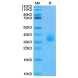 Tris-Bis PAGE - Recombinant Human ANGPTL3 Protein (Biotin) (C-terminal His and Avi Tag) (A330102) - Antibodies.com