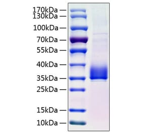 SDS-PAGE - Recombinant Human ANGPTL3 Protein (C-terminal His Tag) (A330103) - Antibodies.com
