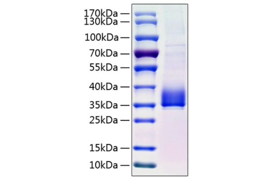 SDS-PAGE - Recombinant Human ANGPTL3 Protein (C-terminal His Tag) (A330103) - Antibodies.com