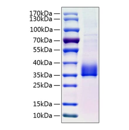 SDS-PAGE - Recombinant Human ANGPTL3 Protein (C-terminal His Tag) (A330103) - Antibodies.com