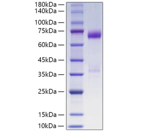 SDS-PAGE - Recombinant Human ANGPTL3 Protein (C-terminal His Tag) (A330104) - Antibodies.com