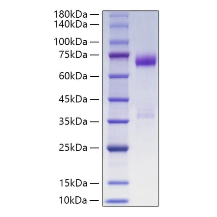 SDS-PAGE - Recombinant Human ANGPTL3 Protein (C-terminal His Tag) (A330104) - Antibodies.com