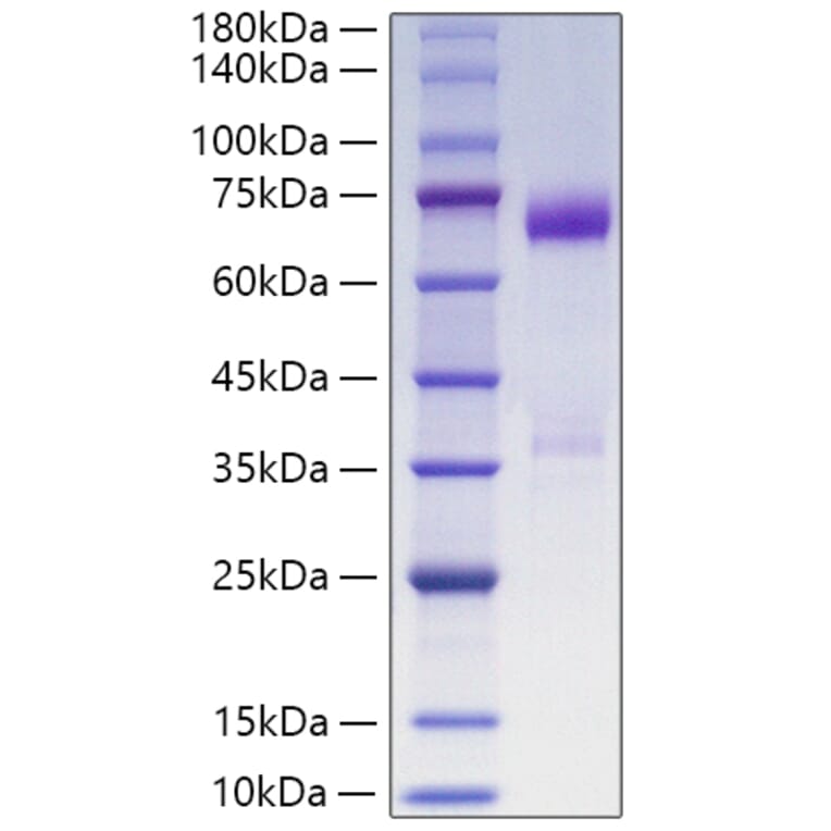 SDS-PAGE - Recombinant Human ANGPTL3 Protein (C-terminal His Tag) (A330104) - Antibodies.com